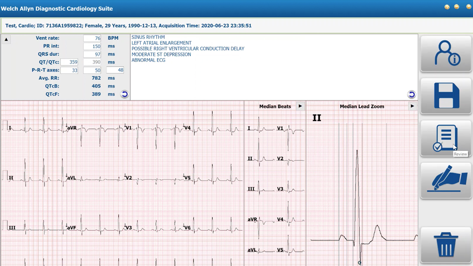Athenahealth workflow video for the Welch Allyn Diagnostic Cardiology Suite ECG